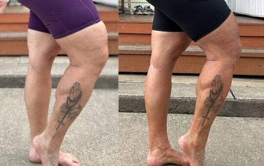 legs before and after b. tan