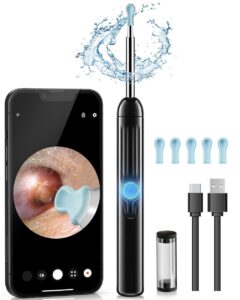 ear wax remover with camera jegoat