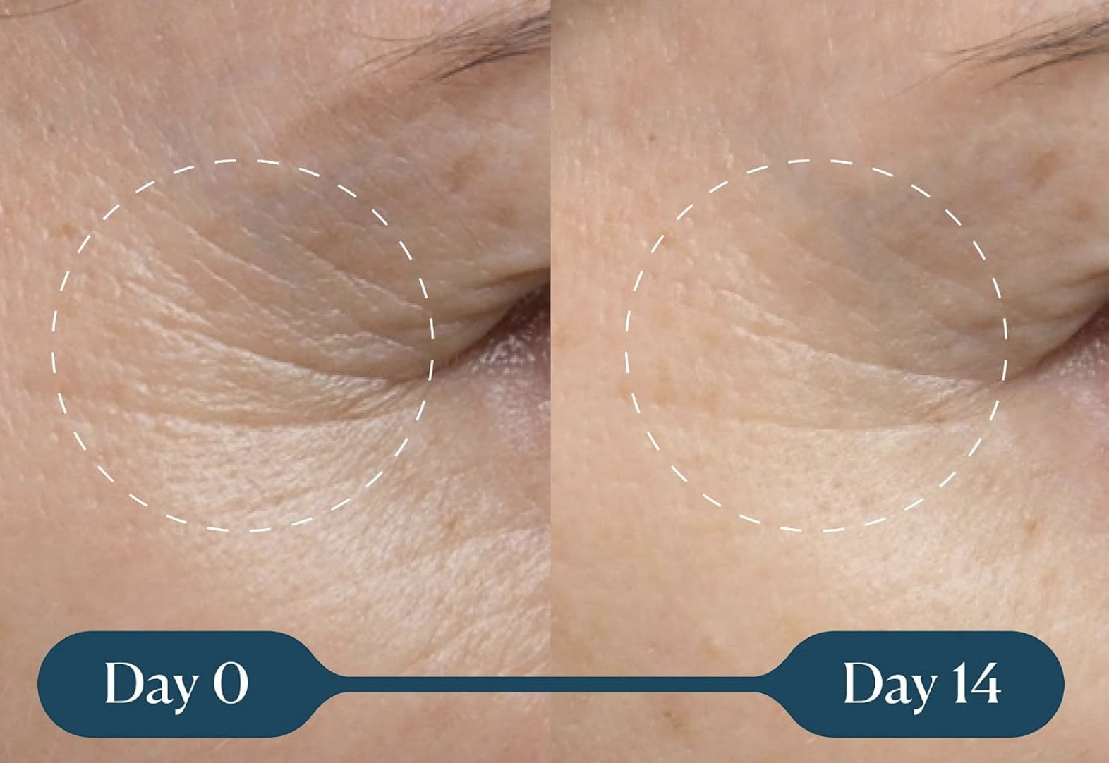 elemis pro collagen